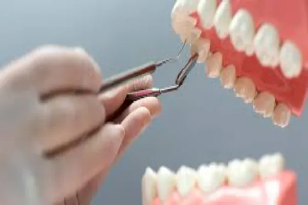 Dental Implants: A Permanent Solution for Missing Teeth